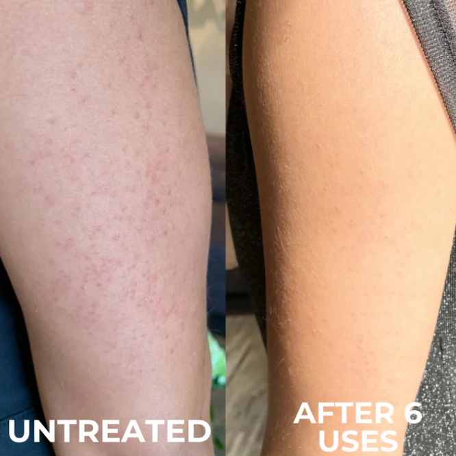 Kinara Clarifying Skin Solution