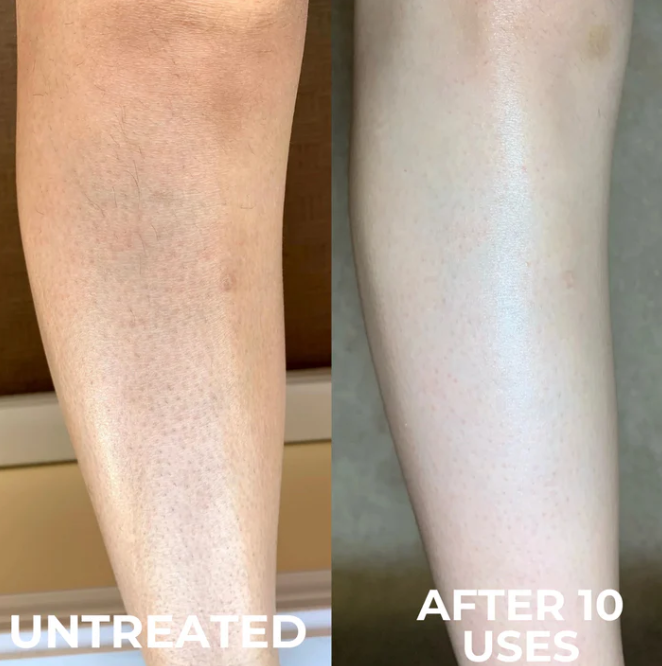 Kinara Clarifying Skin Solution