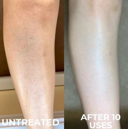 Kinara Clarifying Skin Solution