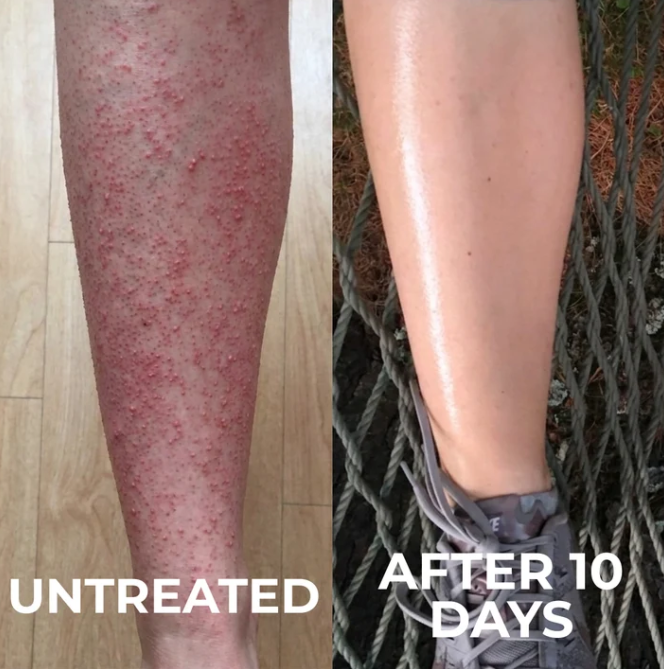 Kinara Clarifying Skin Solution
