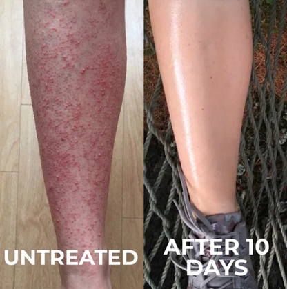 Kinara Clarifying Skin Solution
